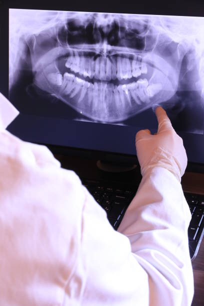 Best Emergency Root Canal Therapy in Boston, MA